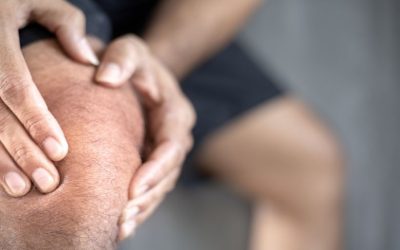 Collagen consumption can relieve knee pain [study]